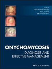 Onychomycosis - Cover
