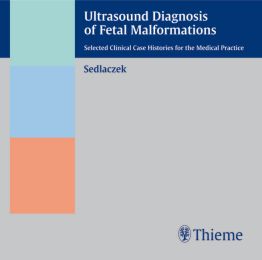 Ultrasound Diagnosis of Fetal Malformations