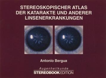 Stereoskopischer Atlas der Katarakte und anderer Linsenerkrankungen