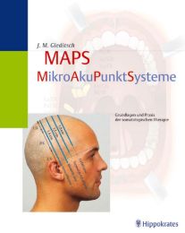 MAPS: MikroAkuPunktSysteme
