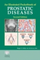 Illustrated Pocketbook of Prostatic Disease