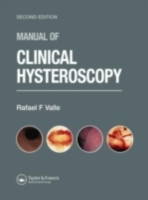Manual of Clinical Hysteroscopy