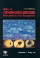 Atlas of Atherosclerosis Progression and Regression