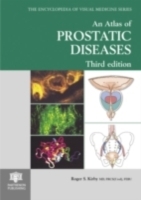 Atlas of Prostatic Diseases