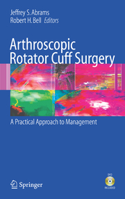 Arthroscopic Rotator Cuff Surgery