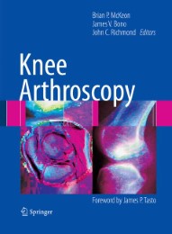 Knee Arthroscopy - Abbildung 1
