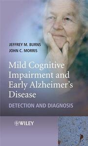 Early Diagnosis and Treatment of Mild Cognitive Impairment