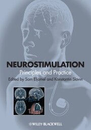 Neurostimulation