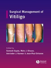 Surgical Management of Vitiligo - Cover