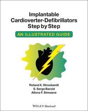 Implantable Cardioverter-Defibrillators Step by Step
