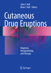 Cutaneous Drug Eruptions