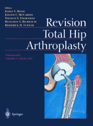 Revision Total Hip Arthroplasty - Abbildung 1