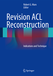 ACL Revision Reconstruction
