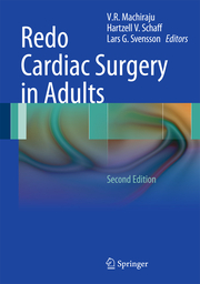 Redo Cardiac Surgery in Adults