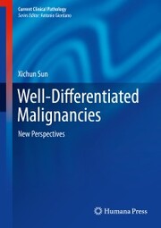 Well-Differentiated Malignancies