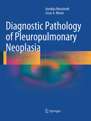Diagnostic Pathology of Pleuropulmonary Neoplasia - Cover