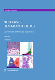 Neoplastic Hematopathology - Cover
