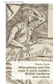 Rhinoplasty and the nose in early modern British medicine and culture