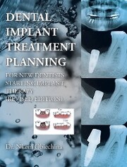 Dental Implant Treatment Planning for New Dentists Starting Implant Therapy - Cover