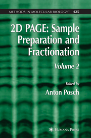 2D PAGE: Sample Preparation and Fractionation 2