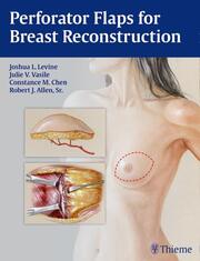 Perforator Flaps for Breast Reconstruction - Cover