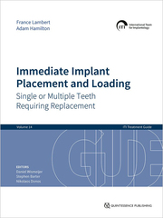 Immediate Implant Placement and Loading - Single or Multiple Teeth Requiring Replacement