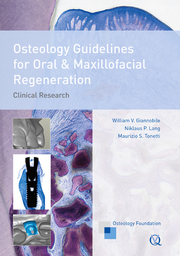 Osteology Guidelines for Oral & Maxillofacial Regeneration