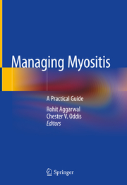 Managing Myositis