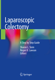 Laparoscopic Colectomy - Cover