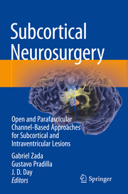 Subcortical Neurosurgery