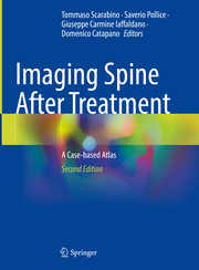 Imaging Spine After Treatment - Cover