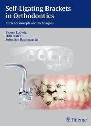 Self-ligating Brackets in Orthodontics - Cover