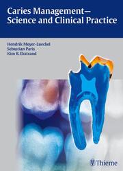 Dental Caries - Science and Clinical Practice - Cover