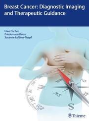 Breast Cancer: Diagnostic Imaging and Therapeutic Guidance