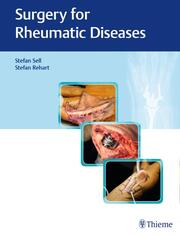 Surgery for Rheumatic Diseases - Cover