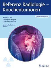 Referenz Radiologie - Knochentumoren
