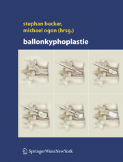 Ballonkyphoplastie - Cover