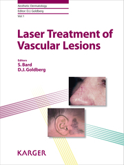 Laser Treatment of Vascular Lesions