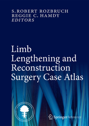 Limb Lengthening and Reconstruction