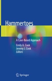 Hammertoes - Cover