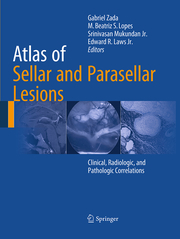 Atlas of Sellar and Parasellar Lesions - Cover