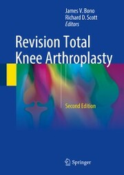 Revision Total Knee Arthroplasty - Cover