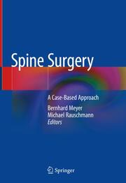 Spine Surgery - Cover