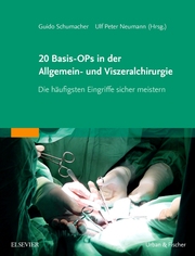 20 Basis-OPs in der Allgemein- und Viszeralchirurgie - Cover