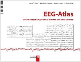 EEG-Atlas