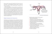 Leben mit Endometriose - Abbildung 1