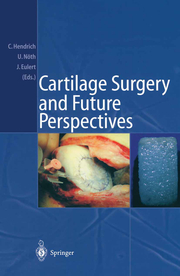 Cartilage Surgery and Future Perspectives - Cover
