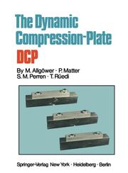 The Dynamic Compression Plate DCP - Cover