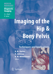 Imaging of the Hip & Hip and Bony Pelvis