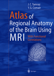 Atlas of Regional Anatomy of the Brain Using MRI